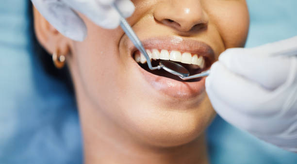 Best Urgent Dental Care for Toothaches in Bryson City, NC