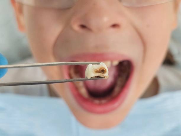 Best Emergency Pediatric Dental Care in Bryson City, NC