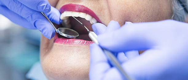 Best Emergency Wisdom Tooth Extraction in Bryson City, NC